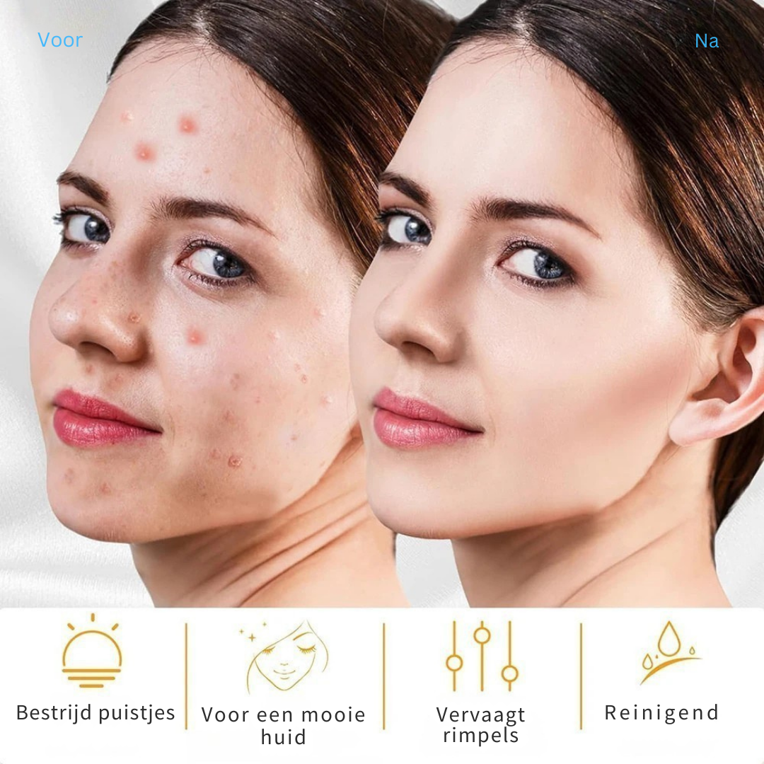 SkinRevive HF Therapy™|Professionele huidverzorging, gewoon bij jou thuis